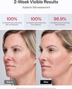 JMOON NouvelleSkin Facial Toning Device, FDA-Cleared Microcurrent Facial Device and Red Light Therapy for Face, 4 Modes & 5 Intensity Levels for Personalized Face Lift & Smoothing. M30U PR