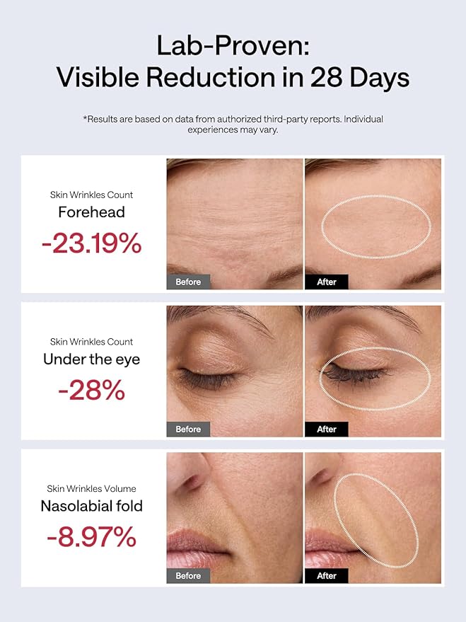 JMOON NouvelleSkin Facial Toning Device, FDA-Cleared Microcurrent Facial Device and Red Light Therapy for Face, 4 Modes & 5 Intensity Levels for Personalized Face Lift & Smoothing. M30U PR