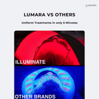Illuminate V2 (VISO PRO)